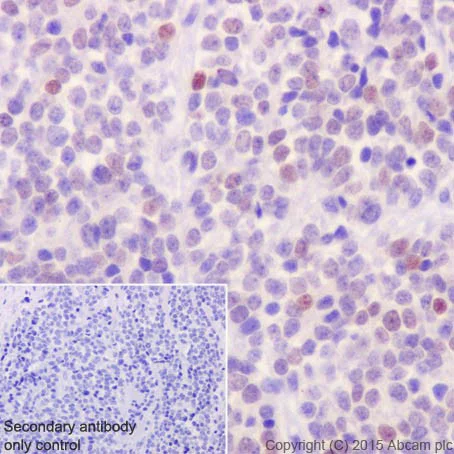 Immunohistochemistry (Formalin/PFA-fixed paraffin-embedded sections) - Anti-GATA2 + GATA3 antibody [EPR17874] (AB182747)