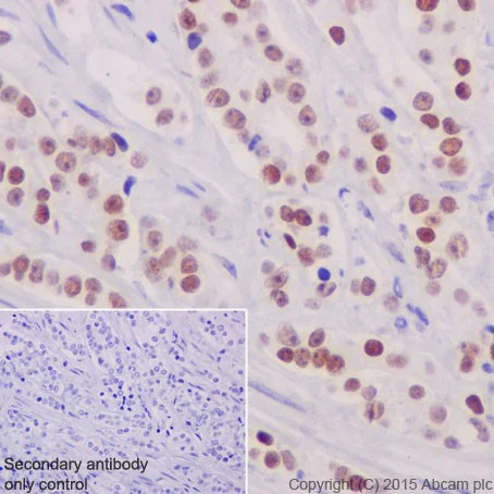 Immunohistochemistry (Formalin/PFA-fixed paraffin-embedded sections) - Anti-GATA2 + GATA3 antibody [EPR17874] - BSA and Azide free (AB250638)