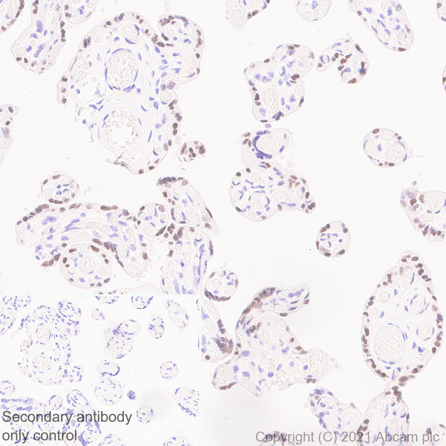 Immunohistochemistry (Formalin/PFA-fixed paraffin-embedded sections) - Anti-GATA2 + GATA3 antibody [EPR24359-3] (ab272237), expandable thumbnail