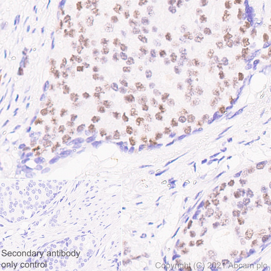 Immunohistochemistry (Formalin/PFA-fixed paraffin-embedded sections) - Anti-GATA2 + GATA3 antibody [EPR24359-3] (ab272237), expandable thumbnail