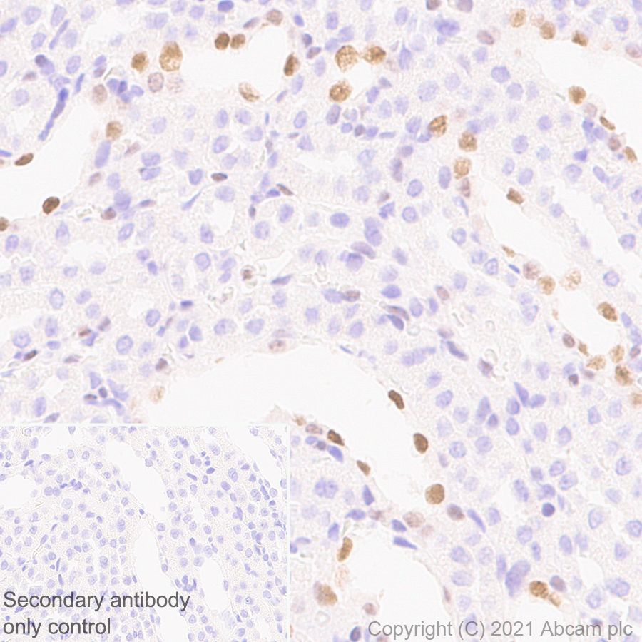 Immunohistochemistry (Formalin/PFA-fixed paraffin-embedded sections) - Anti-GATA2 + GATA3 antibody [EPR24359-3] (ab272237), expandable thumbnail