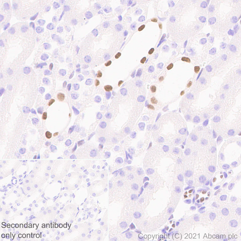 Immunohistochemistry (Formalin/PFA-fixed paraffin-embedded sections) - Anti-GATA2 + GATA3 antibody [EPR24359-3] (AB272237)