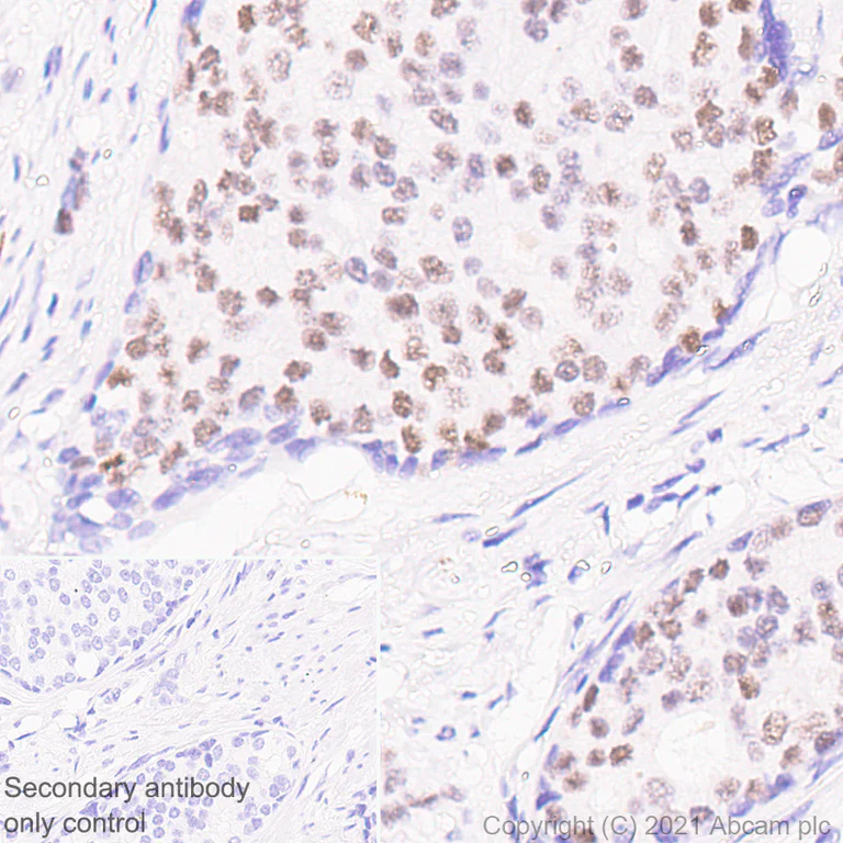 Immunohistochemistry (Formalin/PFA-fixed paraffin-embedded sections) - Anti-GATA2 + GATA3 antibody [EPR24359-3] - BSA and Azide free (AB282124)