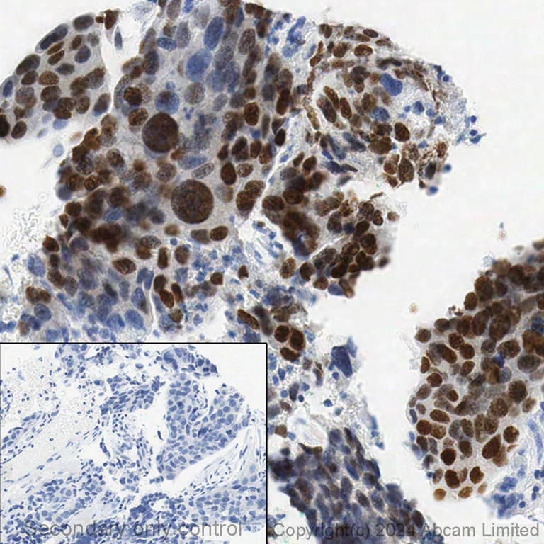 Immunohistochemistry (Formalin/PFA-fixed paraffin-embedded sections) - Anti-GATA3 antibody [EPR16651] - BSA and Azide free (AB214804)