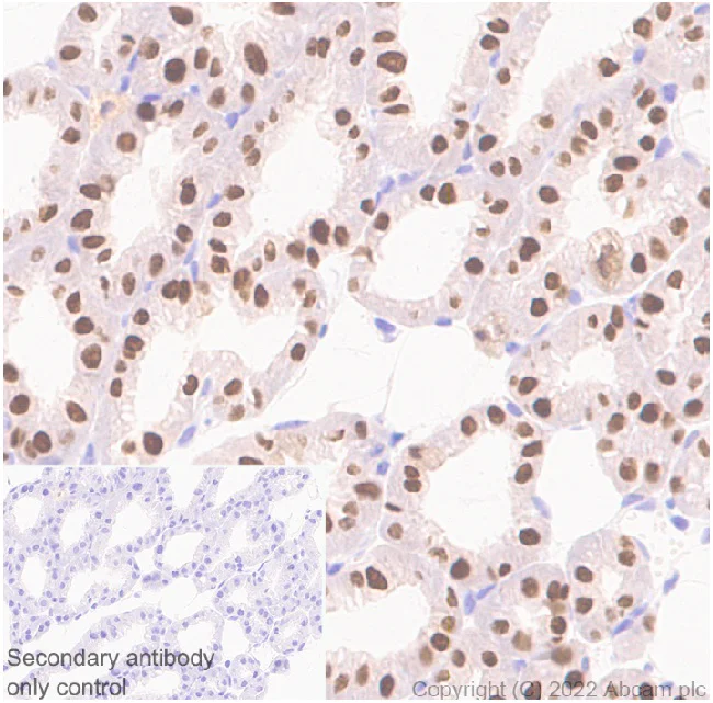 Immunohistochemistry (Formalin/PFA-fixed paraffin-embedded sections) - Anti-GATA3 antibody [EPR16651] - BSA and Azide free (AB214804)