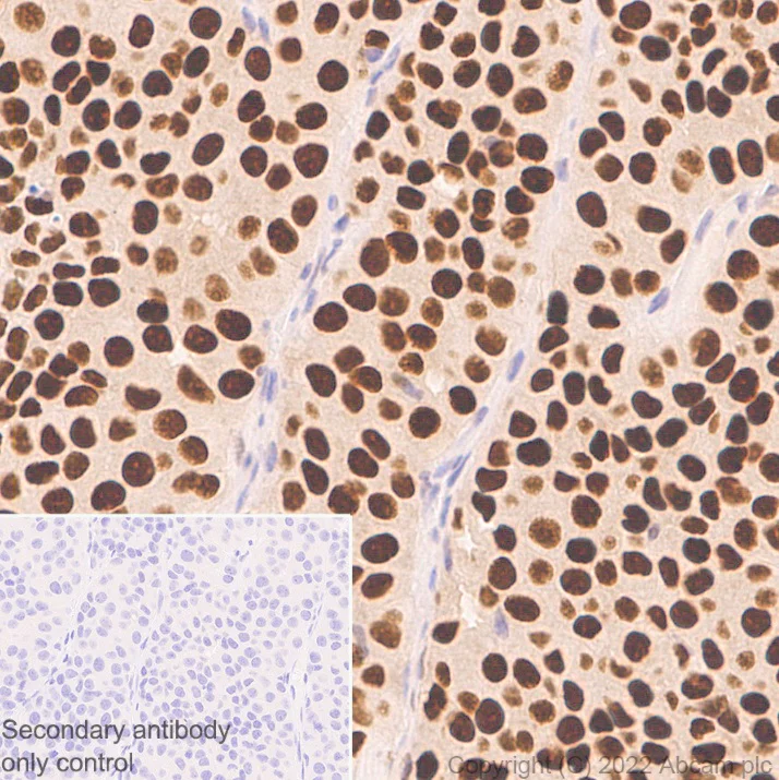 Immunohistochemistry (Formalin/PFA-fixed paraffin-embedded sections) - Anti-GATA3 antibody [EPR16651] - BSA and Azide free (AB214804)