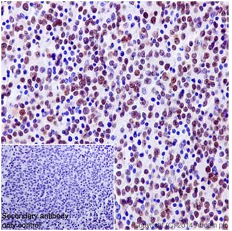 Immunohistochemistry (Formalin/PFA-fixed paraffin-embedded sections) - Anti-GATA3 antibody [EPR16651] - BSA and Azide free (AB214804)
