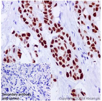 Immunohistochemistry (Formalin/PFA-fixed paraffin-embedded sections) - Anti-GATA3 antibody [EPR16651] - ChIP Grade (AB199428), expandable thumbnail