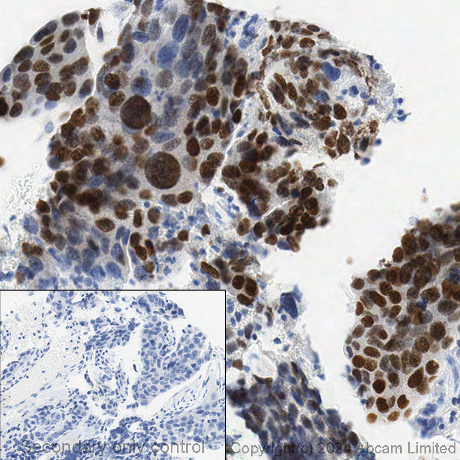 Immunohistochemistry (Formalin/PFA-fixed paraffin-embedded sections) - Anti-GATA3 antibody [EPR16651] - ChIP Grade (ab199428), expandable thumbnail