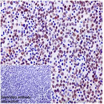 Immunohistochemistry (Formalin/PFA-fixed paraffin-embedded sections) - Anti-GATA3 antibody [EPR16651] - ChIP Grade (AB199428)