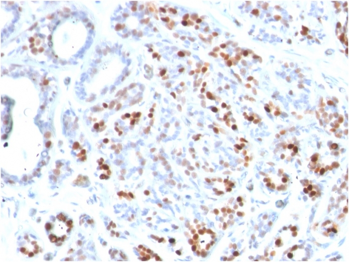 Immunohistochemistry (Formalin/PFA-fixed paraffin-embedded sections) - Anti-GATA3 antibody [GATA3/2444] (AB268065)