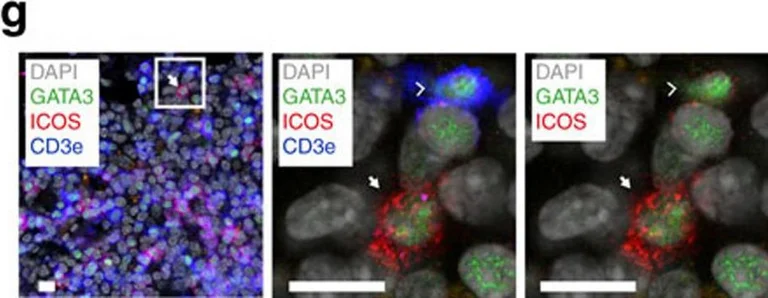 Immunocytochemistry/ Immunofluorescence - Anti-GATA3 antibody [KT77] (AB110093)