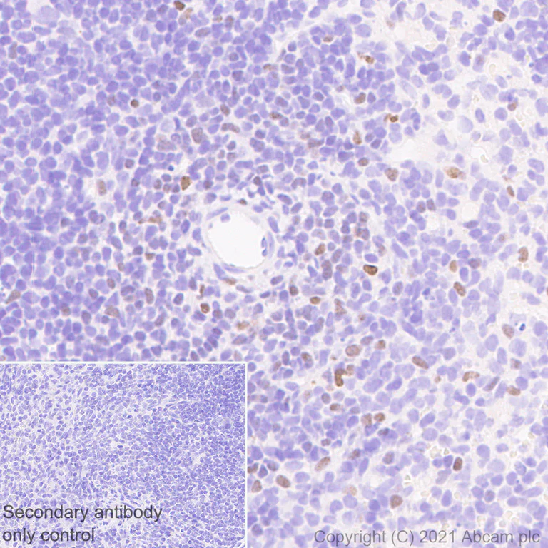 Immunohistochemistry (Formalin/PFA-fixed paraffin-embedded sections) - Anti-GATA3 antibody [L50-823] - BSA and Azide free (AB282130)