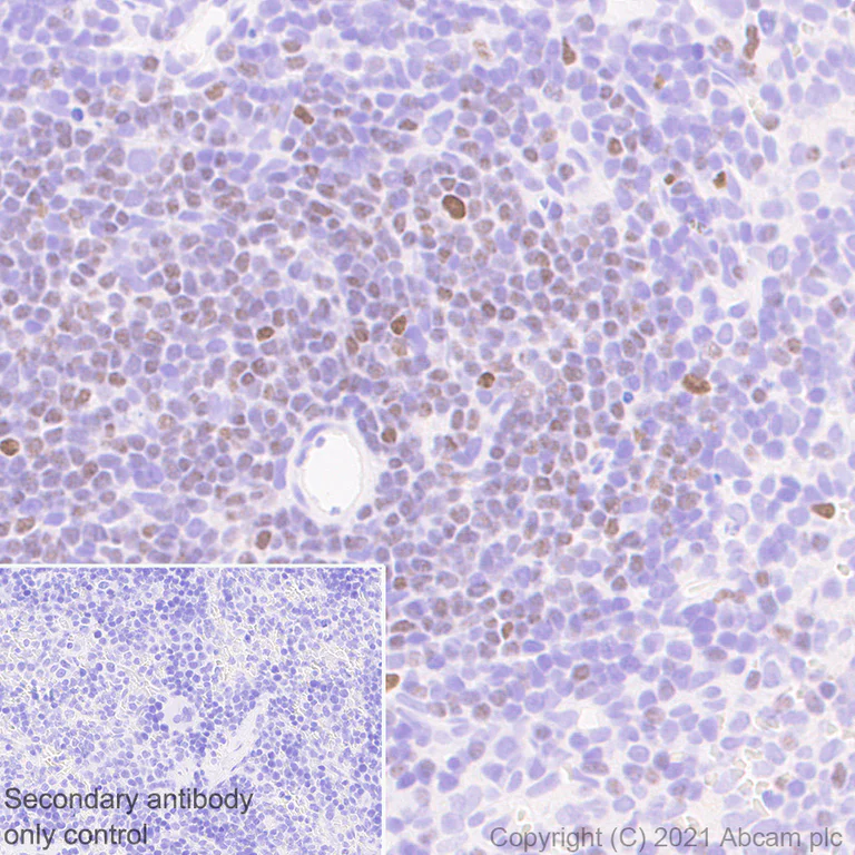 Immunohistochemistry (Formalin/PFA-fixed paraffin-embedded sections) - Anti-GATA3 antibody [L50-823] - BSA and Azide free (AB282130)