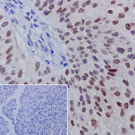 Immunohistochemistry (Formalin/PFA-fixed paraffin-embedded sections) - Anti-GATA3 (phospho S308) antibody [EPR18118] (AB186371)