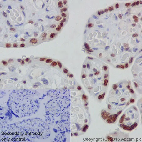 Immunohistochemistry (Formalin/PFA-fixed paraffin-embedded sections) - Anti-GATA3 (phospho S308) antibody [EPR18118] (AB186371)