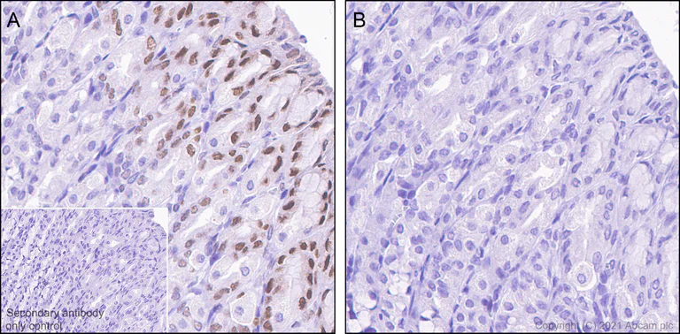 Immunohistochemistry (Formalin/PFA-fixed paraffin-embedded sections) - Anti-GATA3 (phospho S308) antibody [EPR18118] (AB186371)