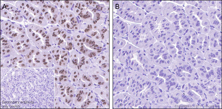 Immunohistochemistry (Formalin/PFA-fixed paraffin-embedded sections) - Anti-GATA3 (phospho S308) antibody [EPR18118] (AB186371)