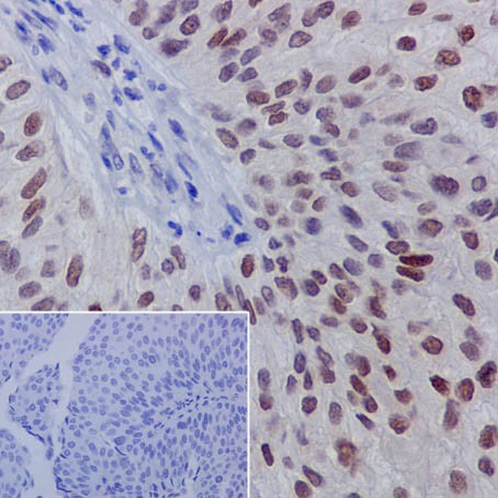 Immunohistochemistry (Formalin/PFA-fixed paraffin-embedded sections) - Anti-GATA3 (phospho S308) antibody [EPR18118] - BSA and Azide free (AB240298)