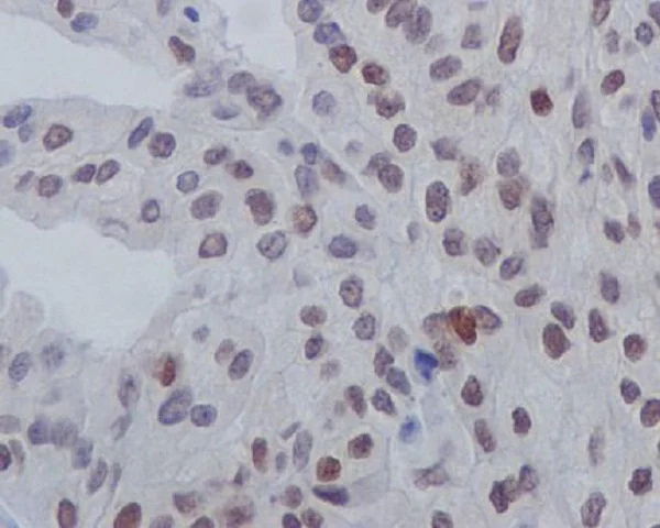 Immunohistochemistry (Formalin/PFA-fixed paraffin-embedded sections) - Anti-GATA3 (phospho S308) antibody [SR1843] (AB326648)