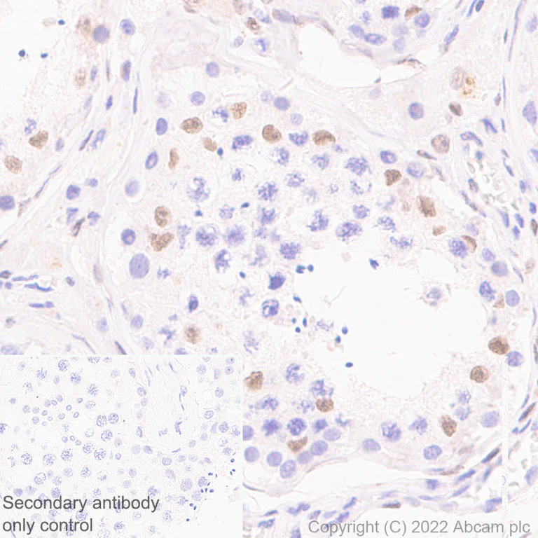 Immunohistochemistry (Formalin/PFA-fixed paraffin-embedded sections) - Anti-GATA4 antibody [EPR26718-103] (AB307823)