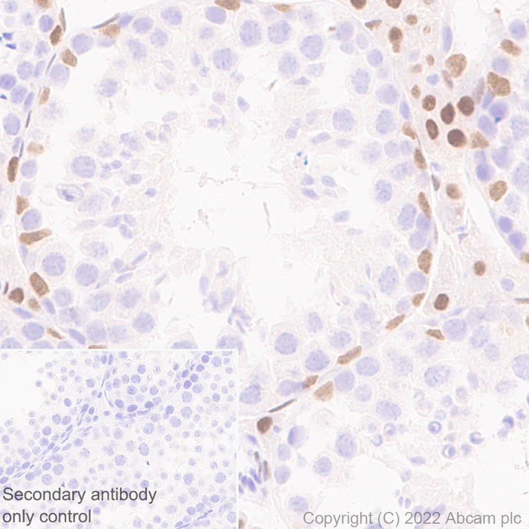 Immunohistochemistry (Formalin/PFA-fixed paraffin-embedded sections) - Anti-GATA4 antibody [EPR26718-103] (AB307823)