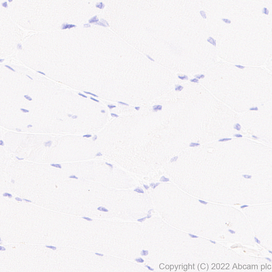 Immunohistochemistry (Formalin/PFA-fixed paraffin-embedded sections) - Anti-GATA4 antibody [EPR26718-103] (ab307823), expandable thumbnail