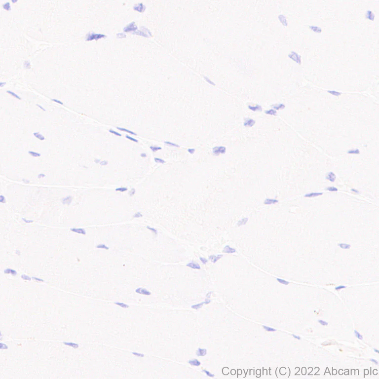 Immunohistochemistry (Formalin/PFA-fixed paraffin-embedded sections) - Anti-GATA4 antibody [EPR26718-103] (AB307823)