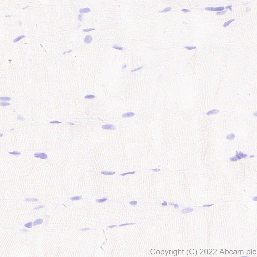 Immunohistochemistry (Formalin/PFA-fixed paraffin-embedded sections) - Anti-GATA4 antibody [EPR26718-103] (AB307823), expandable thumbnail
