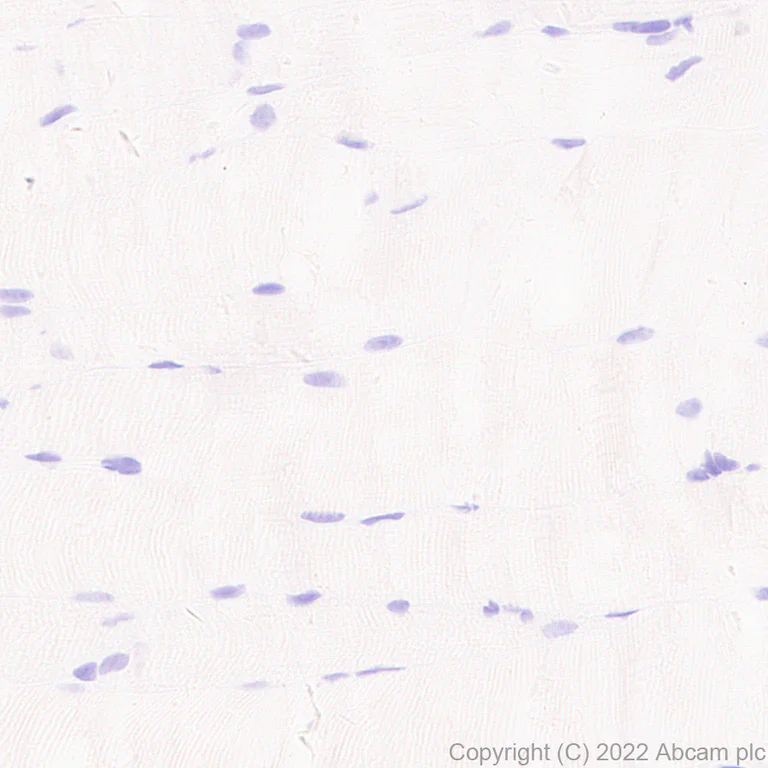 Immunohistochemistry (Formalin/PFA-fixed paraffin-embedded sections) - Anti-GATA4 antibody [EPR26718-103] (AB307823)