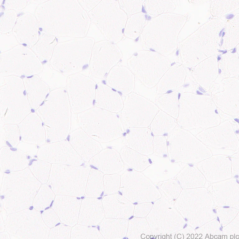 Immunohistochemistry (Formalin/PFA-fixed paraffin-embedded sections) - Anti-GATA4 antibody [EPR26718-103] (AB307823)