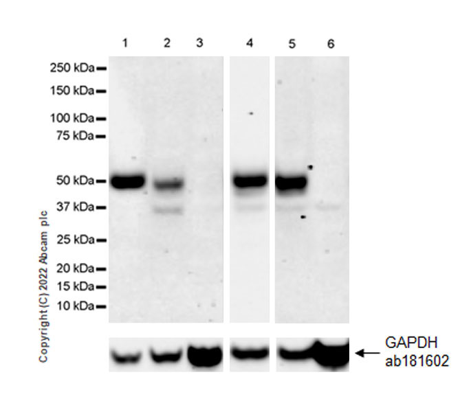 Western blot - Anti-GATA4 antibody [EPR26718-103] (ab307823), expandable thumbnail