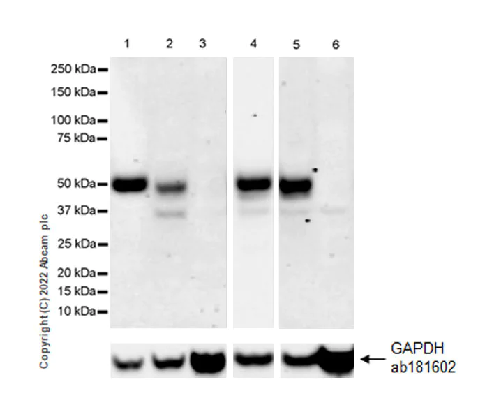 Western blot - Anti-GATA4 antibody [EPR26718-103] (AB307823)