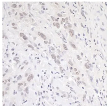 Immunohistochemistry (Formalin/PFA-fixed paraffin-embedded sections) - Anti-GATAD2A antibody (AB87663)