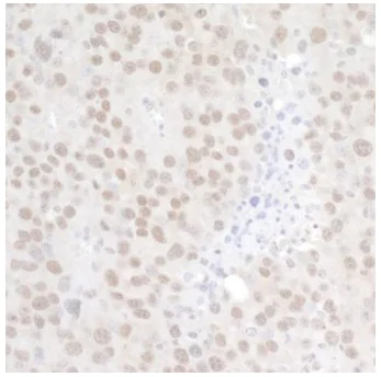 Immunohistochemistry (Formalin/PFA-fixed paraffin-embedded sections) - Anti-GATAD2A antibody (AB87663)