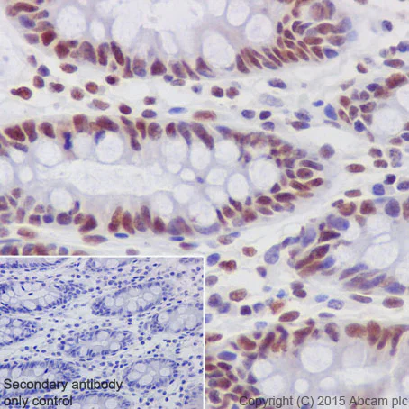 Immunohistochemistry (Formalin/PFA-fixed paraffin-embedded sections) - Anti-GATAD2A antibody [EPR18252] - BSA and Azide free (AB250963)