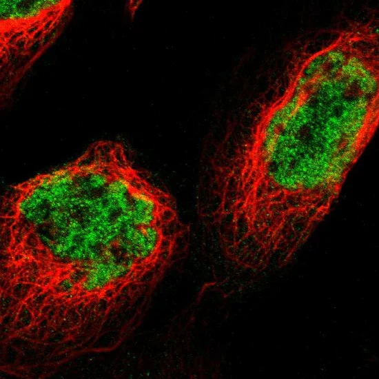 Immunocytochemistry/ Immunofluorescence - Anti-GATAD2B antibody (AB224391)