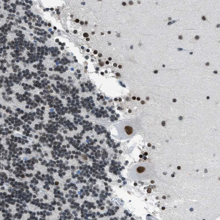 Immunohistochemistry (Formalin/PFA-fixed paraffin-embedded sections) - Anti-GATAD2B antibody (AB224391)