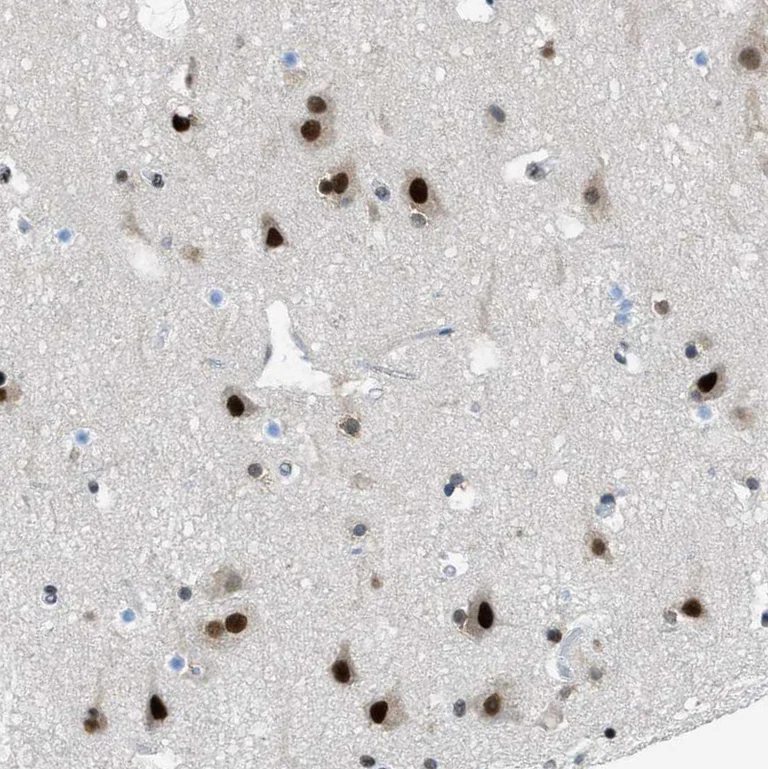 Immunohistochemistry (Formalin/PFA-fixed paraffin-embedded sections) - Anti-GATAD2B antibody (AB224391)