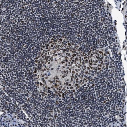 Immunohistochemistry (Formalin/PFA-fixed paraffin-embedded sections) - Anti-GATAD2B antibody (AB224391)