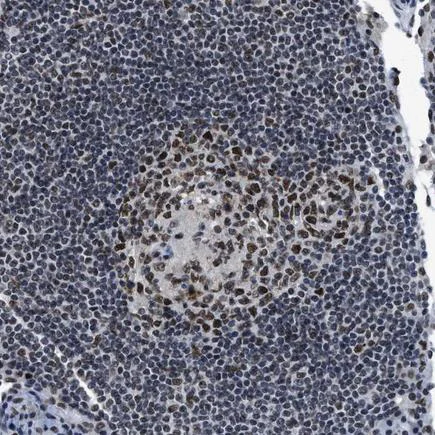 Immunohistochemistry (Formalin/PFA-fixed paraffin-embedded sections) - Anti-GATAD2B antibody (AB224391)