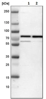Western blot - Anti-GATAD2B antibody (AB224391)