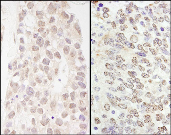 Immunohistochemistry (Formalin/PFA-fixed paraffin-embedded sections) - Anti-GATAD2B antibody (AB76925)