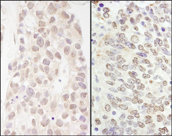 Immunohistochemistry (Formalin/PFA-fixed paraffin-embedded sections) - Anti-GATAD2B antibody (AB76925)