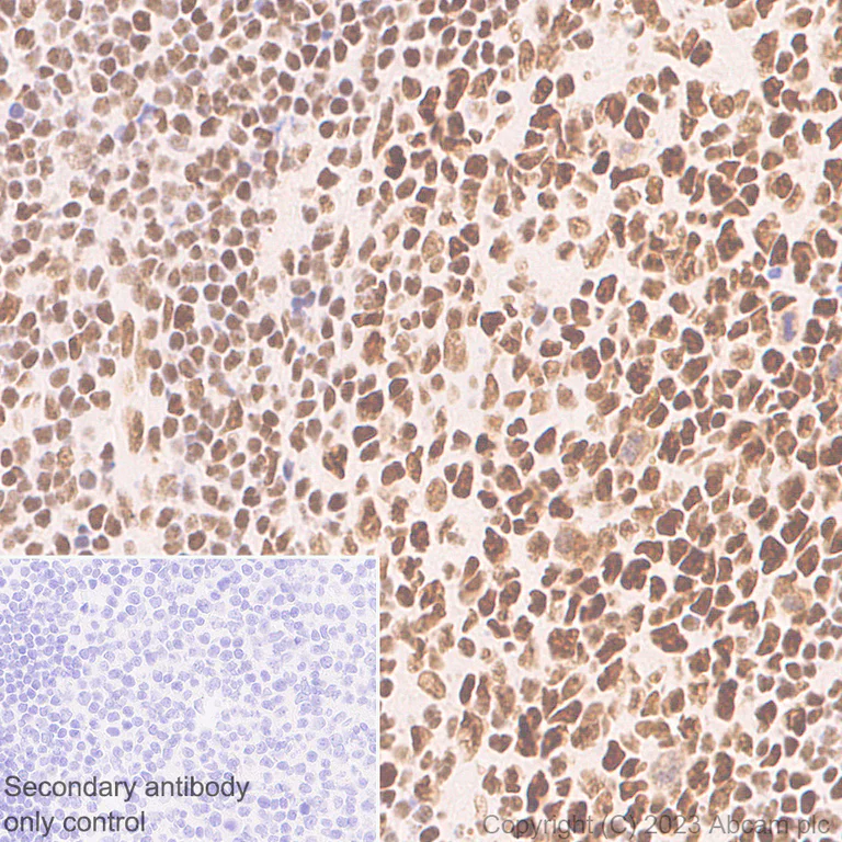 Immunohistochemistry (Formalin/PFA-fixed paraffin-embedded sections) - Anti-GATAD2B antibody [EPR27329-3] - BSA and Azide free (AB308632)