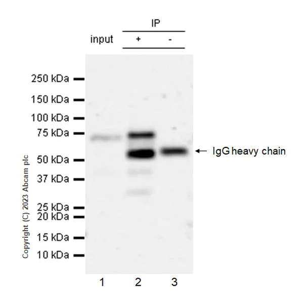Immunoprecipitation - Anti-GATAD2B antibody [EPR27329-3] - BSA and Azide free (AB308632)
