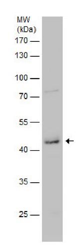 Western blot - Anti-GATM antibody (AB228937)