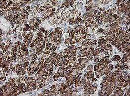 Immunohistochemistry (Formalin/PFA-fixed paraffin-embedded sections) - Anti-GATM antibody [OTI1C9] (AB119269)