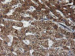 Immunohistochemistry (Formalin/PFA-fixed paraffin-embedded sections) - Anti-GATM antibody [OTI1C9] (AB119269)