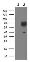 Western blot - Anti-GATM antibody [OTI1C9] (AB119269)